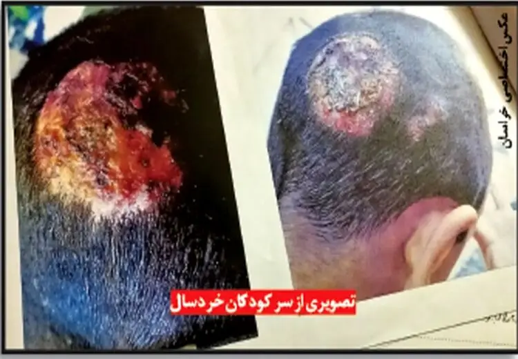 اتهامات کودک‌آزاری، فروش گوشت الاغ و ندادن نفقه در پرونده شوهر ناباب!