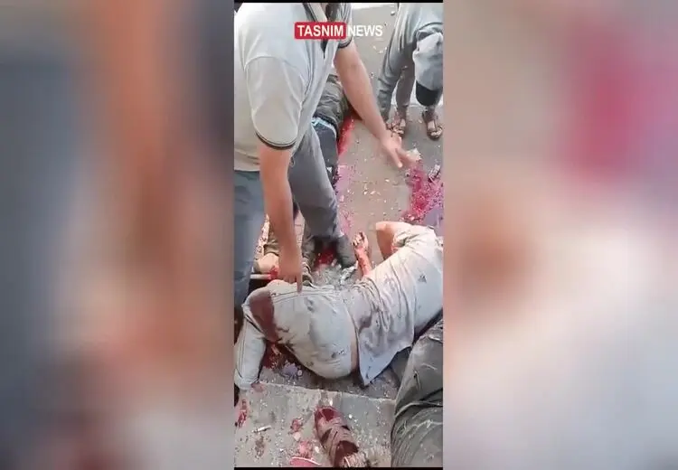 تصاویر دلخراش از بمباران ورودی بیمارستان‌ها در غزه