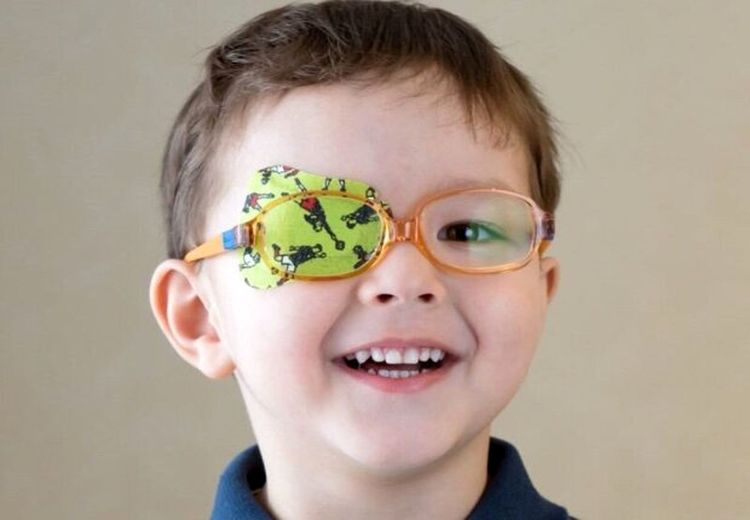 کشف رابطه بین تنبلی چشم در کودکی و ابتلا به بیماری در بزرگسالی
