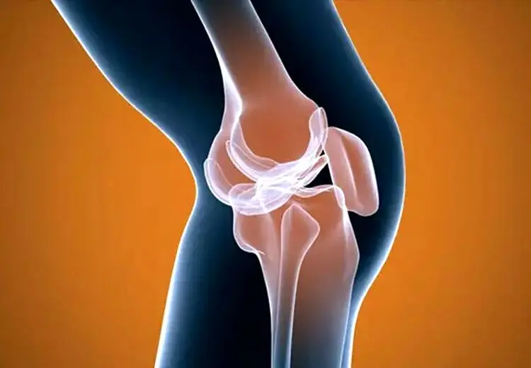 با دیدن چه علایمی نگران ابتلا به آرتروز باشیم؟