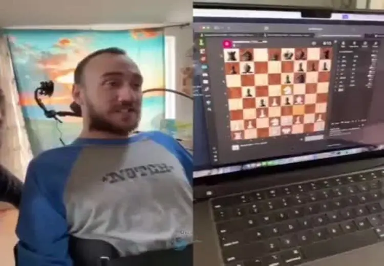 مرد مبتلا به فلج چهار اندام به کمک تراشه مغزی ایلان ماسک شطرنج بازی کرد