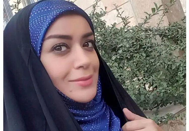 علت تغییر چهره الهام چرخنده چیست؟/ عکس