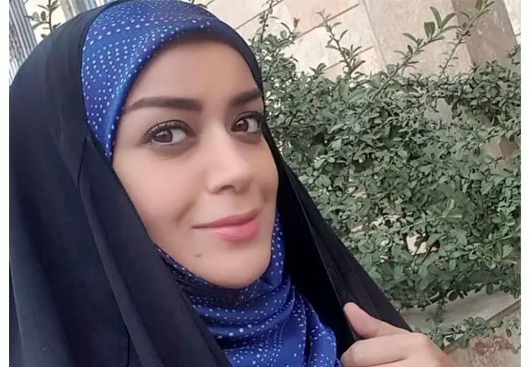 علت تغییر چهره الهام چرخنده چیست؟/ عکس