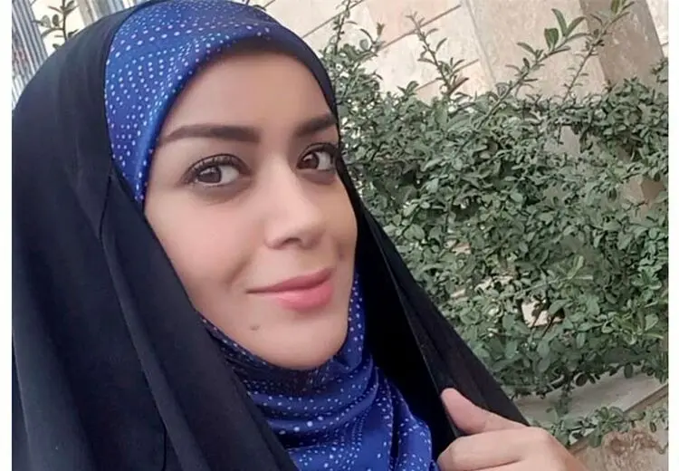 علت تغییر چهره الهام چرخنده چیست؟/ عکس