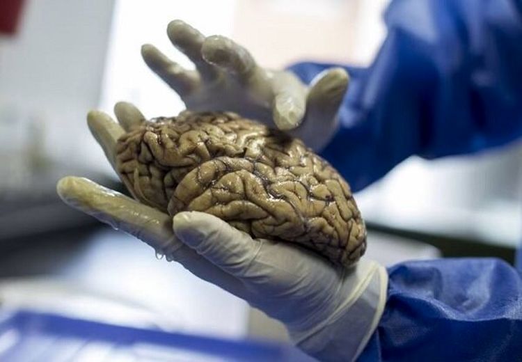 خطرناک‌ترین دشمنان مغز را بشناسید