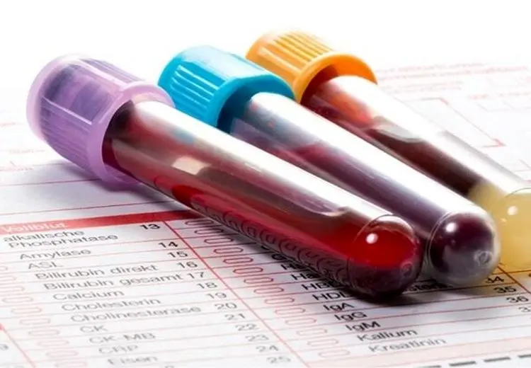 غربالگری در دوران بارداری ممنوع نیست و همچنان انجام می‌شود