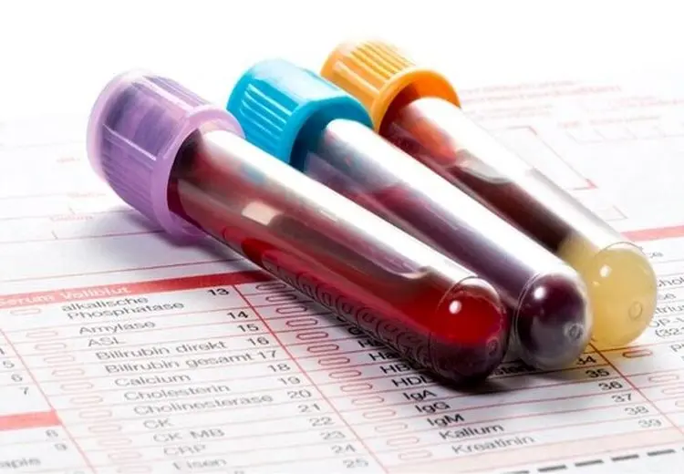 غربالگری در دوران بارداری ممنوع نیست و همچنان انجام می‌شود