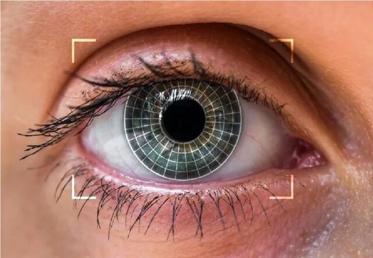 همه چیز درباره تغییر رنگ چشم؛ این جراحی زیبایی پرطرفدار 