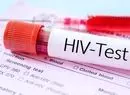 چه کسانی باید آزمایش «ایدز» بدهند؟