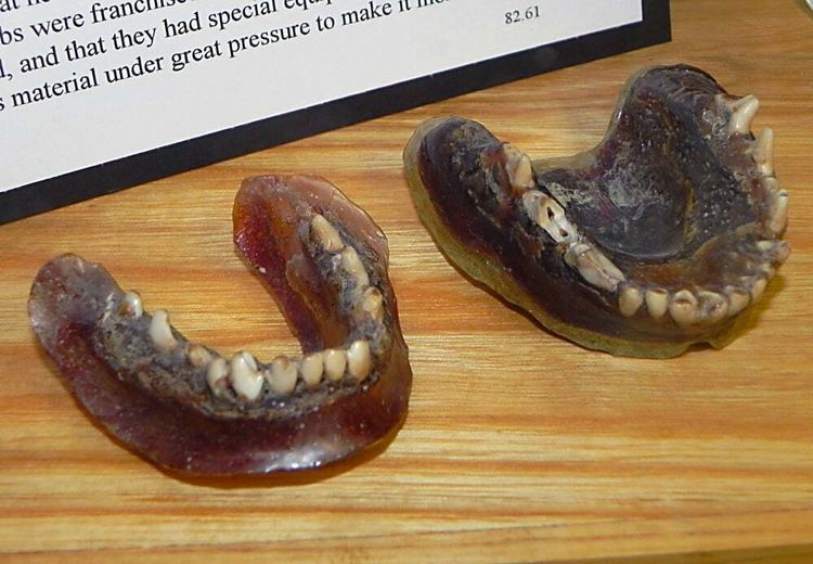 متفاوت‌ترین دندان مصنوعی دنیا در یک موزه + عکس