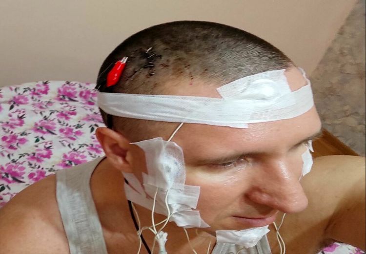 یک محقق روسی با دریل مغزش را سوراخ کرد و در آن تراشه کاشت! + تصاویر