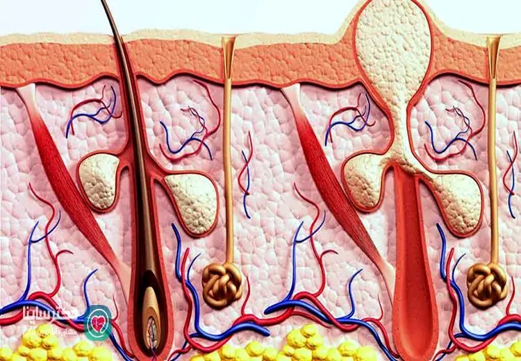 کورک چیست و چرا به وجود می‌آید؟