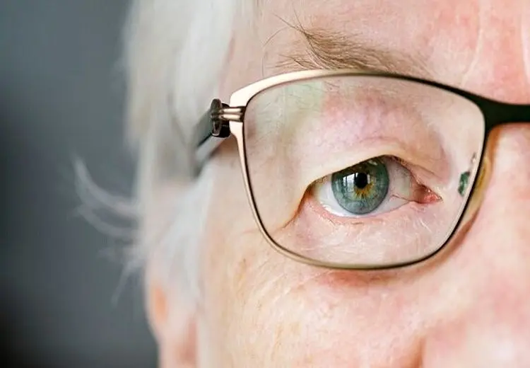 همه آنچه باید درباره پیرچشمی بدانیم