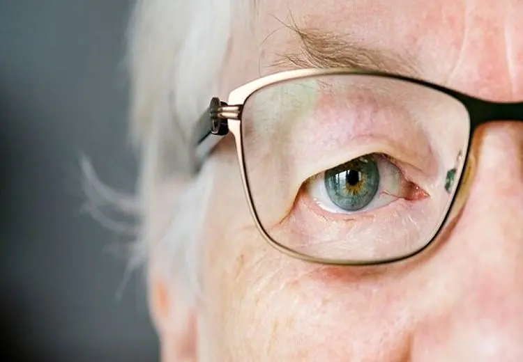 همه آنچه باید درباره پیرچشمی بدانیم