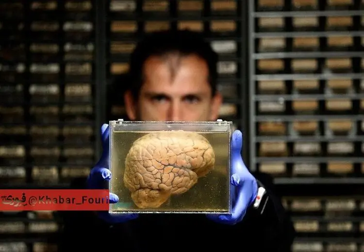 محققان می‌گویند مغز پولدارها دیر پیر می‌شود