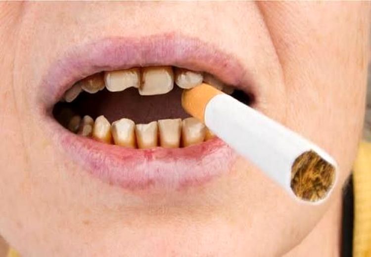 دندان سیگاری‌ها ۴ برابرِ افراد دیگر خراب می‌شود