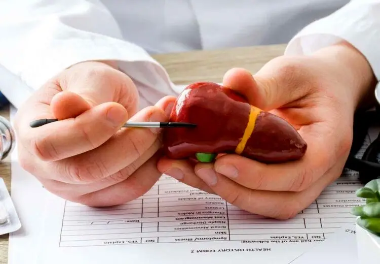 کبد چرب در چه افرادی شایع است؟
