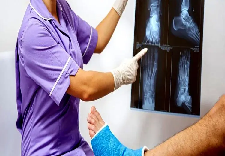 پس از شکستگی استخوان چه کار کنیم؟