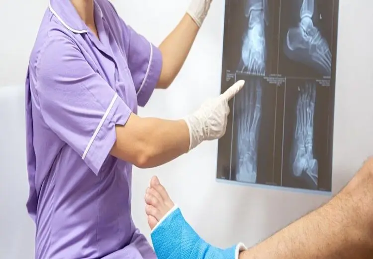 پس از شکستگی استخوان چه کار کنیم؟