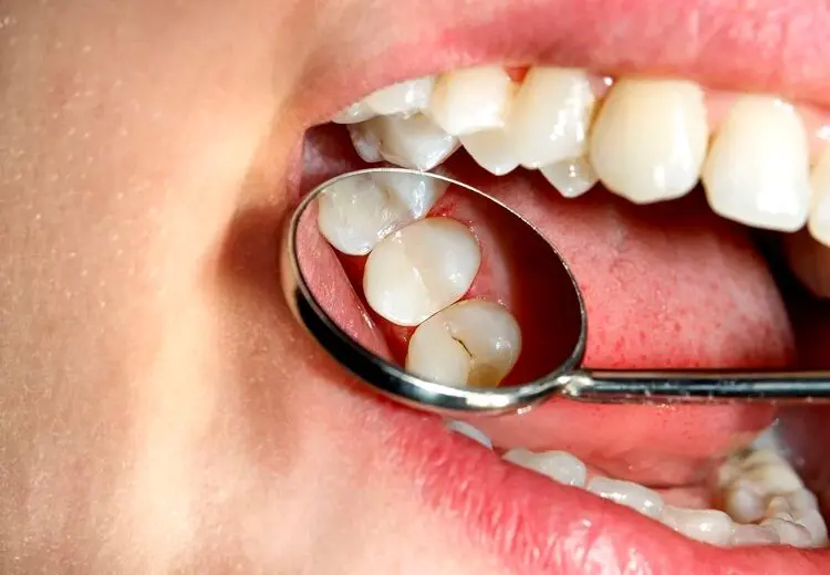 مصرف این نوشیدنی به مینای دندانتان آسیب می زند