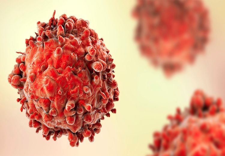 درمان سرطان خون با نانو ذرات لیپیدی