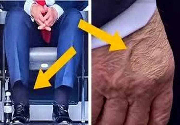 بیماری ترامپ خبرساز شد