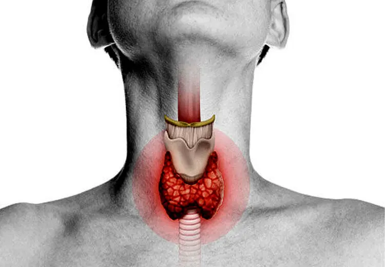 ۴ اقدام برای کمک به سلامت تیروئید