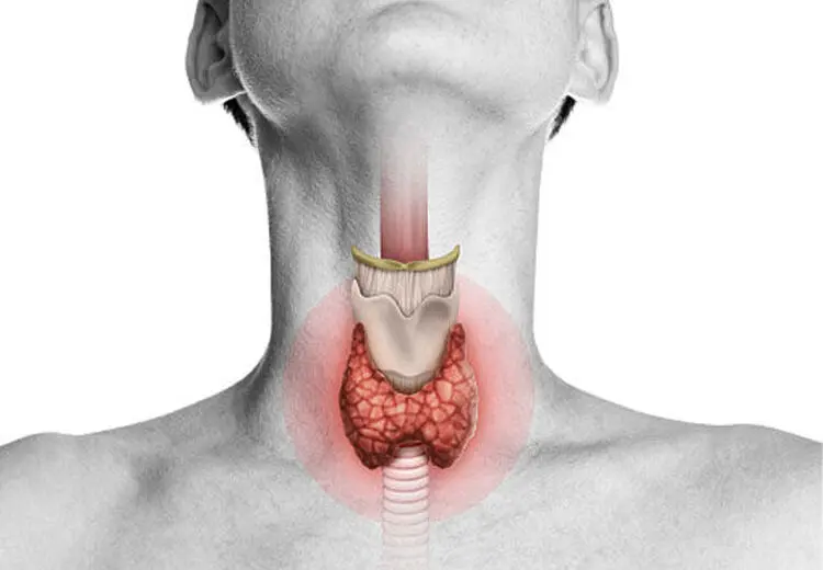 ۴ اقدام برای کمک به سلامت تیروئید
