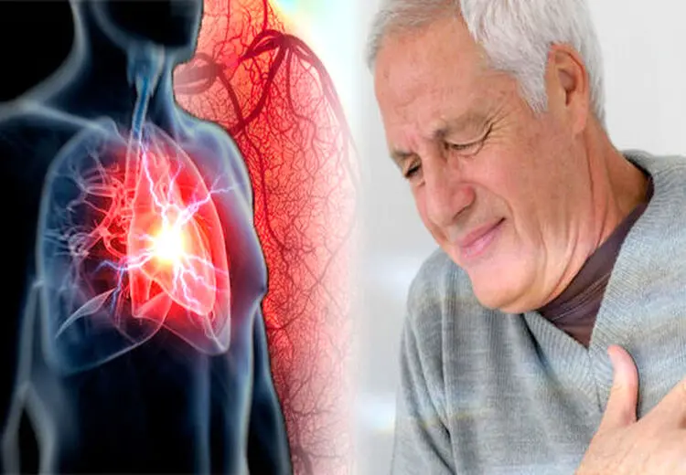 اگر این علائم را دارید؛ رگ های قلبتان گرفته!